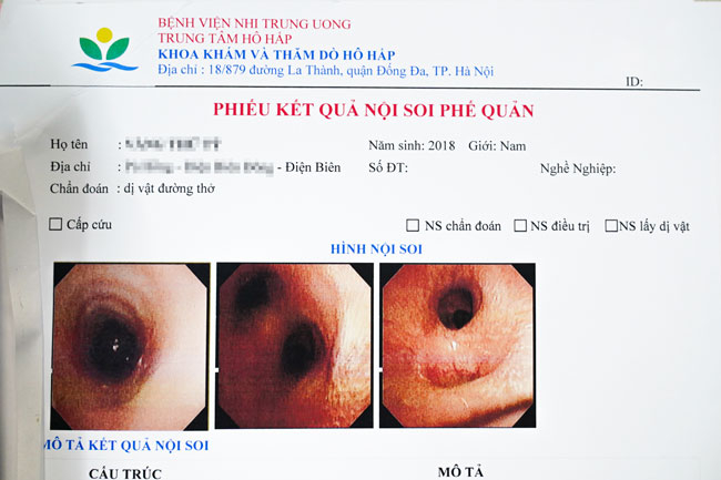 noi soi khi quan