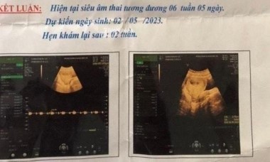 Hiếp dâm, giết người rồi tự sát: Ai phải chịu trách nhiệm bồi thường?